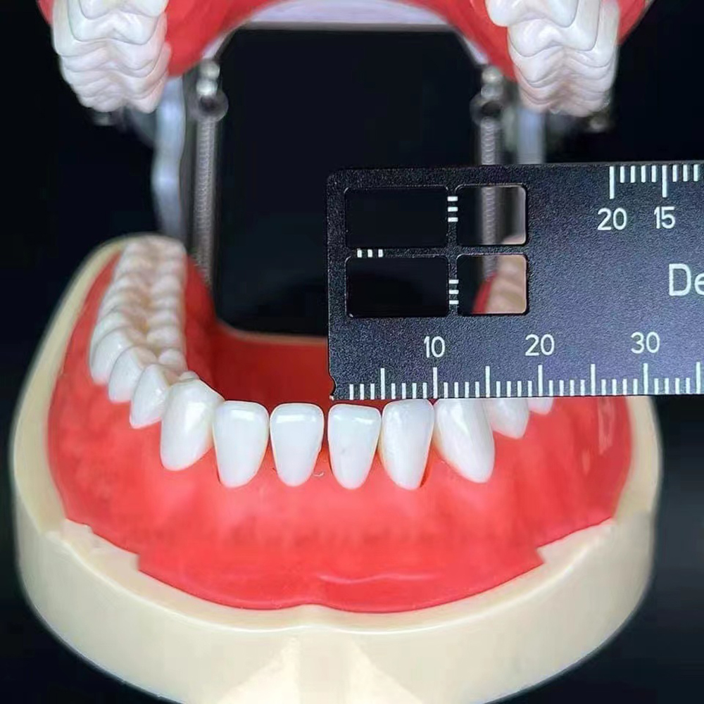 PIORPOY 1 Pcs Dental Precision - огляд і ціна Photography Rules
