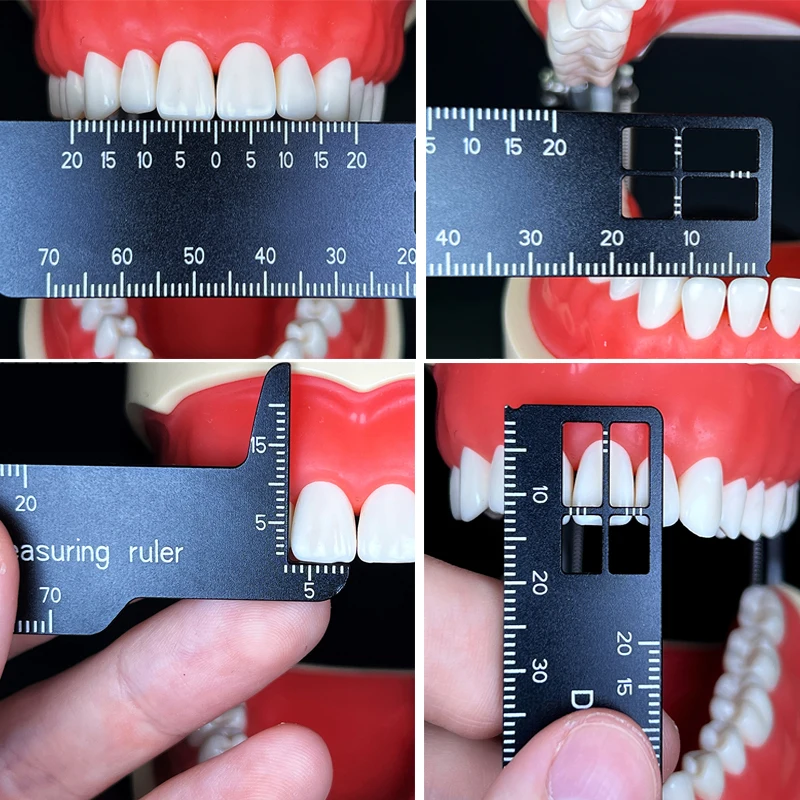 Autoclavable Dental Precision  - огляд і ціна Photography Rules